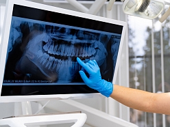 Zobārstniecības prakse Elise NB SIA Liepājā piedāvā mūsdienīgas ārstēšanas metodes, kas atbilst visām kvalitātes prasībām.