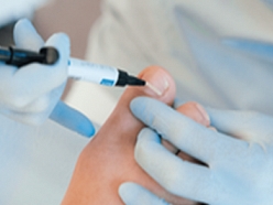 Ieauguša naga korekcija