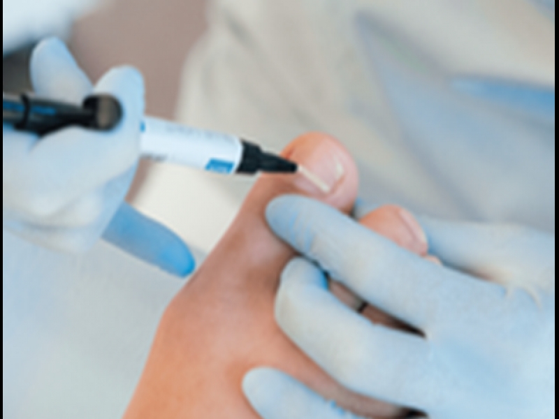 Ieauguša naga korekcija