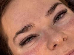 Skropstu pieaudzēšana