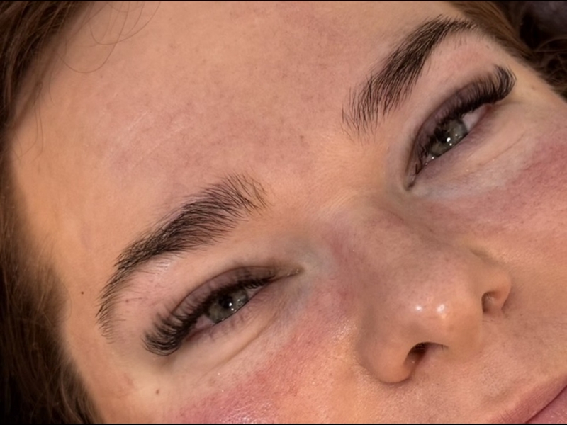 Skropstu pieaudzēšana