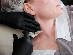 Mērķtiecīga kakla zonas estētiskā procedūra, kas palīdz uzlabot ādas struktūru, tonusu un vispārējo izskatu. Individuāla pieeja katram pacientam garantē harmonisku un līdzsvarotu rezultātu.