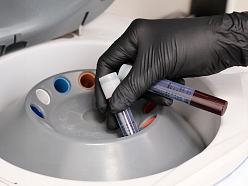 Precīza un sterila asins paraugu apstrāde, kas ir būtiska augstas kvalitātes estētisko un atjaunojošo procedūru nodrošināšanai.