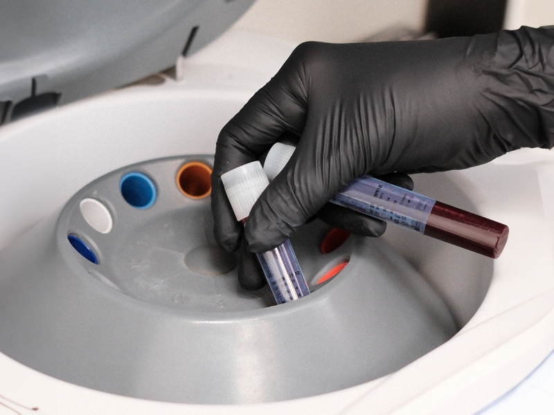 Precīza un sterila asins paraugu apstrāde, kas ir būtiska augstas kvalitātes estētisko un atjaunojošo procedūru nodrošināšanai.