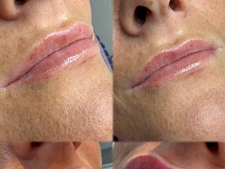 Permanentais grims lūpām