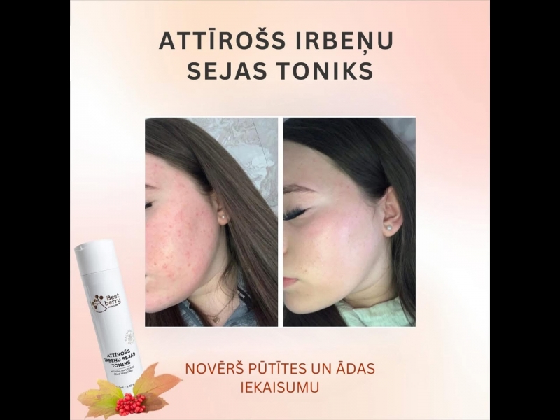 Attīrošs irbeņu sejas toniks