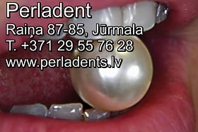 Perladents