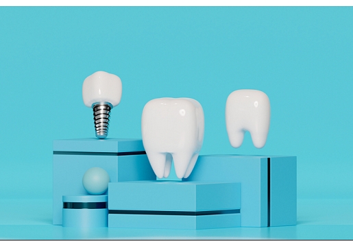 Biežākie mīti par zobu implantoloģiju – skaidro veselības un skaistuma centra Adoria eksperti