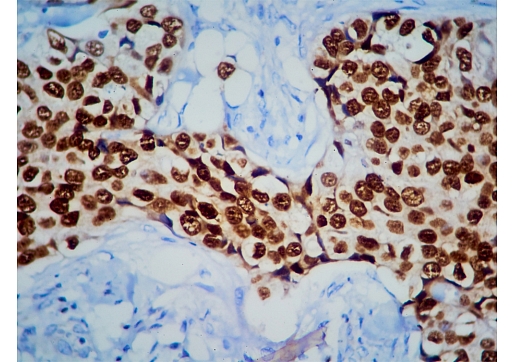 Imūnhistoķīmija un tās nozīme diagnostikā